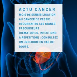 [Actu santé] cancer de la vessie