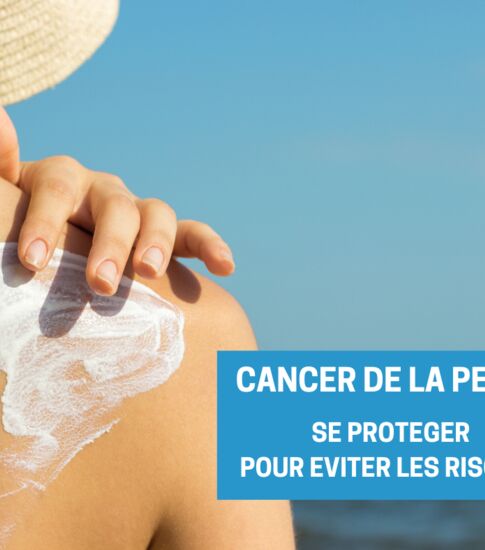 CANCER DE LA PEAU : on se protège !